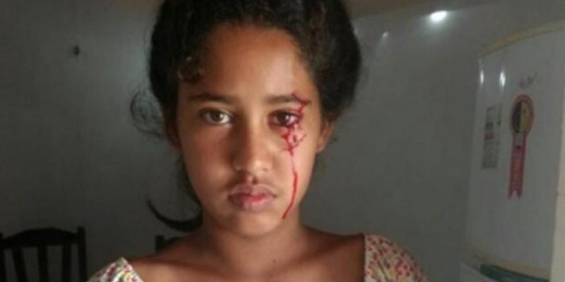 Aos 12 anos, menina do Piauí busca diagnóstico após 'chorar' sangue (Foto: Reprodução/Arquivo Pessoal)