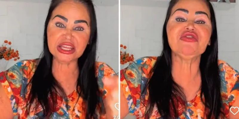 Mãe de Eduardo Costa nega harmonização facial — Foto: Instagram