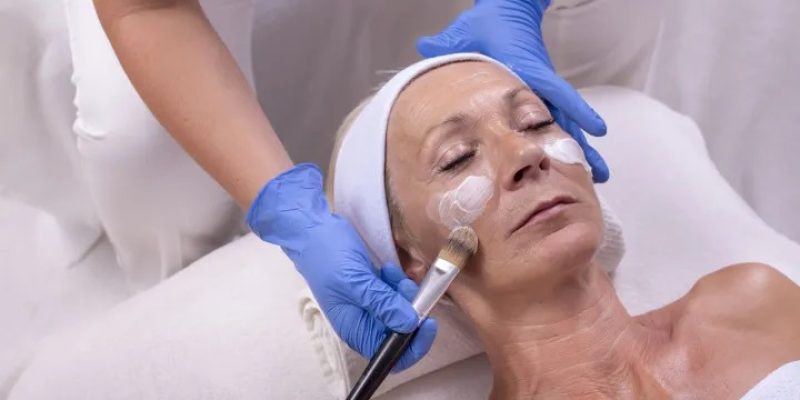 Peeling de fenol só deve ser feito com especialista.  (Divulgação/SAÚDE é Vital)