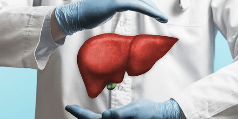 Entenda a fila de transplante de fígado –  imagem - Dr. Matheus Takahashi