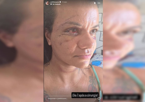 Imagens - Reprodução / Redes sociais