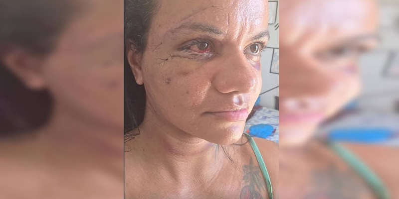 Imagens - Reprodução / Redes sociais
