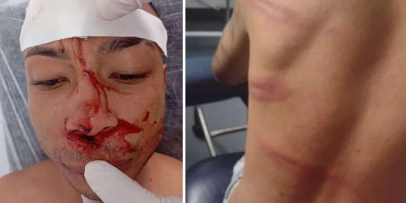 Jovens denunciam agressão por parte de policiais que trabalham no carnaval de Corumbá - Imagens - Marlon Vinícius