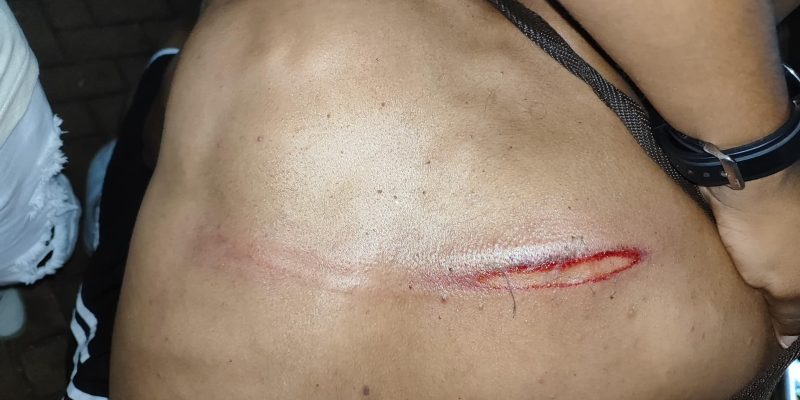 Violência contra foliões assusta população