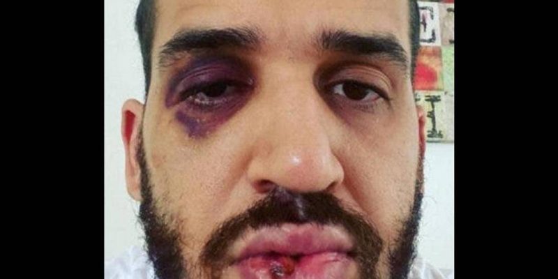 Médico é agredido depois de defender lockdown em Toledo, no Paraná - Foto: Reprodução