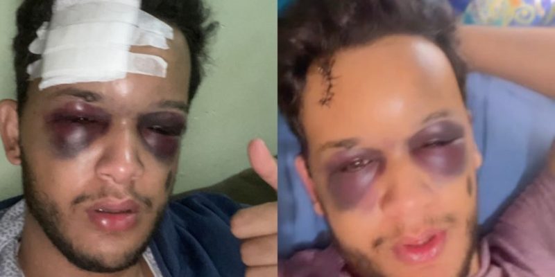 Hugo já está se recuperando - Imagem - Reprodução: Instagram/@hugoeraphael